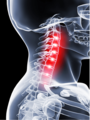 Participate in a Stanford Chronic Pain Study and Receive $200 Cash 3